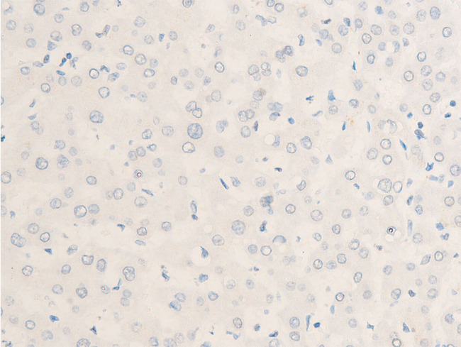 MYC / c-Myc Antibody - 1:100 staining human liver tissue by IHC-P. The tissue was formaldehyde fixed and a heat mediated antigen retrieval step in citrate buffer was performed. The tissue was then blocked and incubated with the antibody for 1.5 hours at 22°C. An HRP conjugated goat anti-rabbit antibody was used as the secondary.