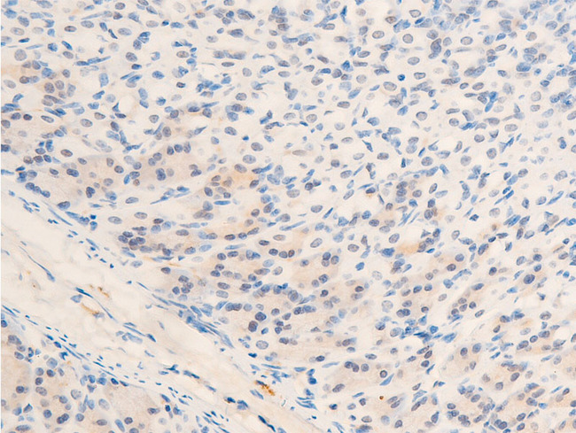 MYC / c-Myc Antibody - 1:100 staining mouse gastric tissue by IHC-P. The tissue was formaldehyde fixed and a heat mediated antigen retrieval step in citrate buffer was performed. The tissue was then blocked and incubated with the antibody for 1.5 hours at 22°C. An HRP conjugated goat anti-rabbit antibody was used as the secondary.
