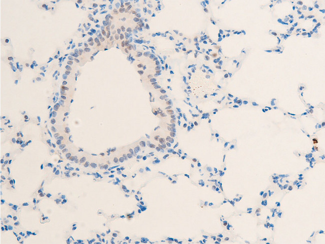 MYC / c-Myc Antibody - 1:100 staining mouse lung tissue by IHC-P. The tissue was formaldehyde fixed and a heat mediated antigen retrieval step in citrate buffer was performed. The tissue was then blocked and incubated with the antibody for 1.5 hours at 22°C. An HRP conjugated goat anti-rabbit antibody was used as the secondary.