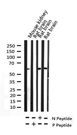 MYC / c-Myc Antibody - Western blot analysis of Phospho-Myc (Thr58) expression in various lysates