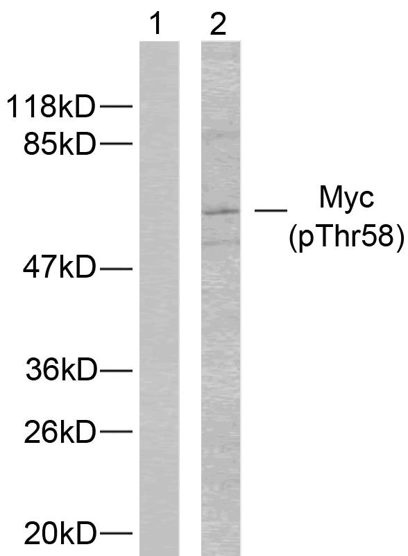 MYC / c-Myc Antibody - Western blot analysis of extracts from ovary cancer cells using Myc (phospho-Thr58) antibody.