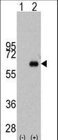 MYC / c-Myc Antibody - Western blot of MYC (arrow) using rabbit polyclonal MYC Antibody (S62). 293 cell lysates (2 ug/lane) either nontransfected (Lane 1) or transiently transfected with the MYC gene (Lane 2) (Origene Technologies).