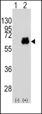 MYC / c-Myc Antibody - Western blot of MYC (arrow) using rabbit polyclonal MYC Antibody (T58). 293 cell lysates (2 ug/lane) either nontransfected (Lane 1) or transiently transfected with the MYC gene (Lane 2) (Origene Technologies).