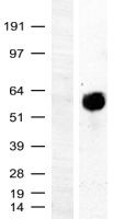 MYC / c-Myc Protein - Western validation with an anti-DDK antibody * L: Control HEK293 lysate R: Over-expression lysate