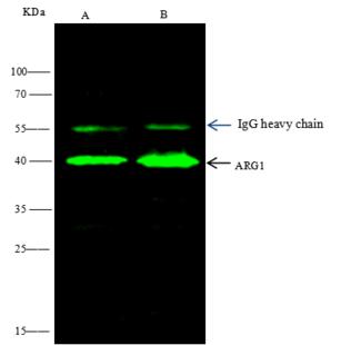 Myc Tag Antibody - MYC was immunoprecipitated using: Lane A: 0.5 mg HA-ARG1-myc Whole Cell Lysate. Lane B: 0.5 mg myc-ARG1-HA Whole Cell Lysate. 4 uL anti-MYC rabbit polyclonal antibody and 60 ug of Immunomagnetic beads Protein A/G. Primary antibody: Anti-MYC rabbit polyclonal antibody, at 1:100 dilution. Secondary antibody: Goat Anti-Rabbit IgG (H+L)/HRP at 1/10000 dilution. Developed using the ECL technique. Performed under reducing conditions. Predicted band size: 40 kDa. Observed band size: 40 kDa.