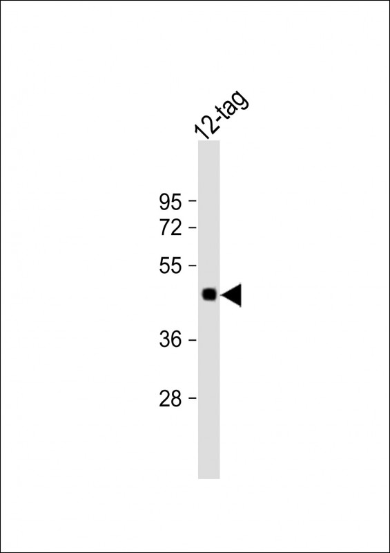 Myc Tag Antibody - Anti-Myc Tag Antibody at 1:2000 dilution + 12-tag protein lysate Lysates/proteins at 20 µg per lane. Predicted band size: 45 kDa Blocking/Dilution buffer: 5% NFDM/TBST.