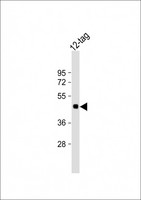 Myc Tag Antibody - Anti-Myc Tag Antibody at 1:2000 dilution + 12-tag protein lysate Lysates/proteins at 20 µg per lane. Predicted band size: 45 kDa Blocking/Dilution buffer: 5% NFDM/TBST.