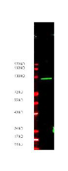 Myc Tag Antibody - Anti-Myc epitope tag Antibody - Western Blot. Anti-Myc epitope tag polyclonal antibody detects ~100 kD CARBOXY terminal linked Myc-tagged recombinant protein present in ~35 ug of lysate by western blot. Carboxy terminal linked Myc recombinant protein was the gift of Zhongsheng You, Salk Institute, LaJolla, CA.