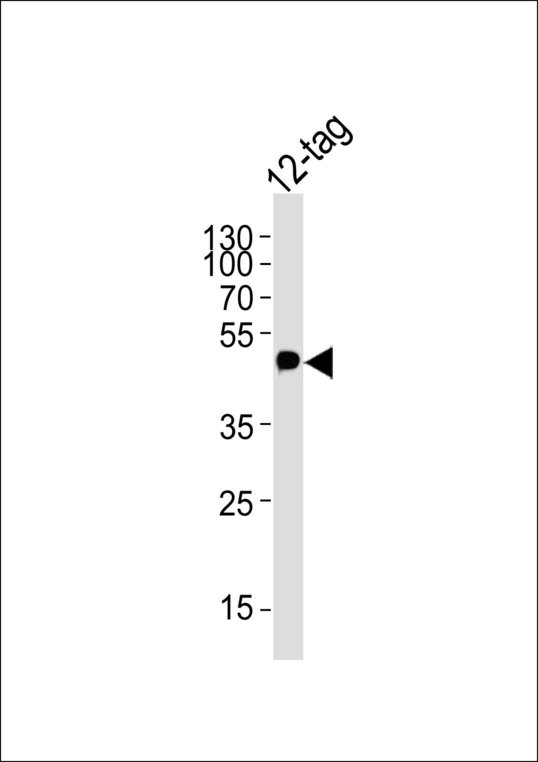 Myc Tag Antibody - Western blot of 12-tag protein lysate, using Myc Tag Antibody. Antibody was diluted at 1:2000. A goat anti-mouse IgG H&L (HRP) at 1:3000 dilution was used as the secondary antibody. Lysate at 20ug.