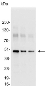 Myc Tag Antibody - Detection of c-myc-tagged protein in 200, 200, or 50ng of E. coli lysate containing tagged fusion protein