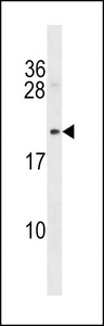 Mycb Antibody - Rat Mycb Antibody western blot of mouse bladder tissue lysates (35 ug/lane). The Mycb antibody detected the Mycb protein (arrow).