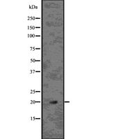 Mycb Antibody - Western blot analysis of MYCB using K562 whole lysates.