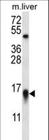 MYCBP Antibody - MYCBP Antibody western blot of mouse liver tissue lysates (35 ug/lane). The MYCBP antibody detected the MYCBP protein (arrow).