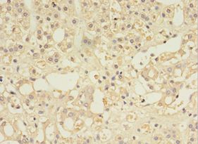 MYCBP Antibody - Immunohistochemistry of paraffin-embedded human adrenal gland using antibody at 1:100 dilution.  This image was taken for the unconjugated form of this product. Other forms have not been tested.
