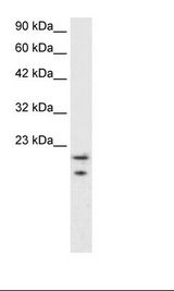 MYCBP Antibody - HepG2 Cell Lysate.  This image was taken for the unconjugated form of this product. Other forms have not been tested.