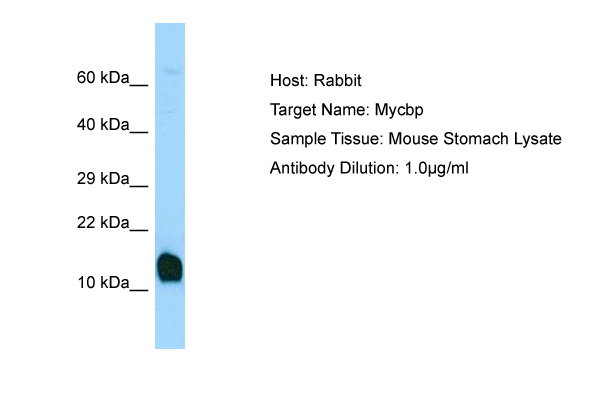 MYCBP Antibody -  This image was taken for the unconjugated form of this product. Other forms have not been tested.