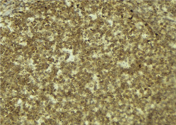 MYCBP Antibody - 1:100 staining mouse pancreas tissue by IHC-P. The sample was formaldehyde fixed and a heat mediated antigen retrieval step in citrate buffer was performed. The sample was then blocked and incubated with the antibody for 1.5 hours at 22°C. An HRP conjugated goat anti-rabbit antibody was used as the secondary.