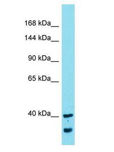 MYCBPAP Antibody - MYCBPAP antibody Western Blot of Uterus Tumor. Antibody dilution: 1 ug/ml.  This image was taken for the unconjugated form of this product. Other forms have not been tested.