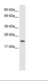 MYCL / L-Myc Antibody - Fetal Kidney Lysate.  This image was taken for the unconjugated form of this product. Other forms have not been tested.