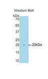 MYCL / L-Myc Antibody - Western blot of recombinant MYCL / L-Myc.  This image was taken for the unconjugated form of this product. Other forms have not been tested.