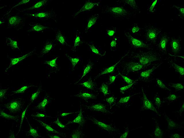 MYCL / L-Myc Antibody - Immunofluorescence staining of MYCL in HeLa cells. Cells were fixed with 4% PFA, permeabilzed with 0.3% Triton X-100 in PBS, blocked with 10% serum, and incubated with rabbit anti-Human MYCL polyclonal antibody (dilution ratio 1:100) at 4°C overnight. Then cells were stained with the Alexa Fluor 488-conjugated Goat Anti-rabbit IgG secondary antibody (green). Positive staining was localized to Nucleus and Cytoplasm.