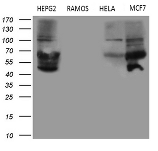 MYCN / N-myc Antibody - Western blot analysis of extracts. (35ug) from 4 different cell lines by using anti-MYCN monoclonal antibody. (1:500)