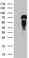 MYCN / N-myc Antibody - HEK293T cells were transfected with the pCMV6-ENTRY control. (Left lane) or pCMV6-ENTRY MYCN. (Right lane) cDNA for 48 hrs and lysed. Equivalent amounts of cell lysates. (5 ug per lane) were separated by SDS-PAGE and immunoblotted with anti-MYCN. (1:500)
