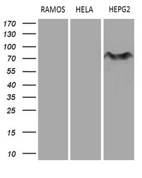 MYCN / N-myc Antibody - Western blot analysis of extracts. (35ug) from 3 different cell lines by using anti-MYCN monoclonal antibody. (HepG2: human; HeLa: human; RAMOS: human). (1:500)