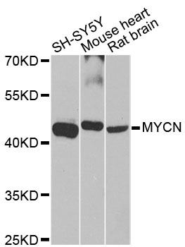 MYCN / N-myc Antibody - Western blot analysis of extracts of various cell lines, using MYCN antibody at 1:1000 dilution. The secondary antibody used was an HRP Goat Anti-Rabbit IgG (H+L) at 1:10000 dilution. Lysates were loaded 25ug per lane and 3% nonfat dry milk in TBST was used for blocking. An ECL Kit was used for detection and the exposure time was 90s.