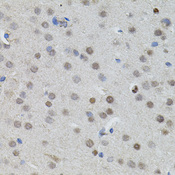 MYCN / N-myc Antibody - Immunohistochemistry of paraffin-embedded mouse brain using MYCN antibody(40x lens).