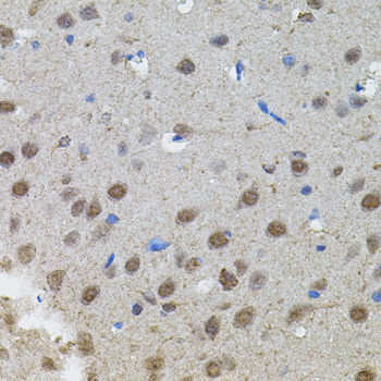 MYCN / N-myc Antibody - Immunohistochemistry of paraffin-embedded rat brain using MYCN antibody(40x lens).