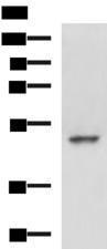MYCN / N-myc Antibody - Western blot analysis of Hela cell lysate  using MYCN Polyclonal Antibody at dilution of 1:800