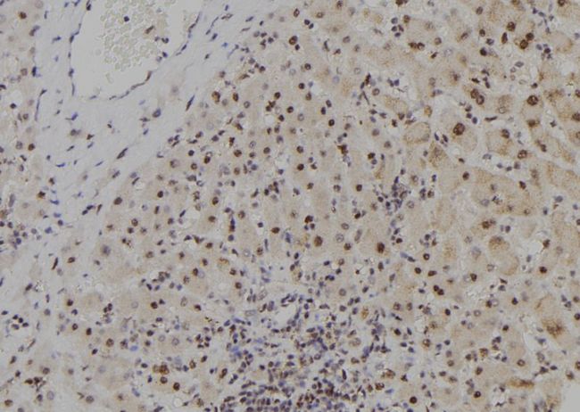 MYCNOS Antibody - 1:100 staining human liver tissue by IHC-P. The sample was formaldehyde fixed and a heat mediated antigen retrieval step in citrate buffer was performed. The sample was then blocked and incubated with the antibody for 1.5 hours at 22°C. An HRP conjugated goat anti-rabbit antibody was used as the secondary.