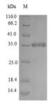 dps Protein - (Tris-Glycine gel) Discontinuous SDS-PAGE (reduced) with 5% enrichment gel and 15% separation gel.