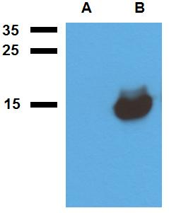 Mycobacterium tuberculosis Acr1 Antibody - Western blotting analysis of polyclonal anti-Mycobacterium tuberculosis antigen Acr1. A) cell lysate of non-transfected E. coli, B) cell lysate of Acr1-transfected E. coli