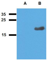 Mycobacterium tuberculosis Acr2 Antibody - Western blotting analysis of polyclonal anti-Mycobacterium tuberculosis antigen Acr2. A) cell lysate of non-transfected E. coli, B) cell lysate of Acr2-transfected E. coli
