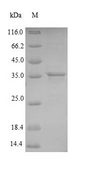 Adenylate Kinase Protein - (Tris-Glycine gel) Discontinuous SDS-PAGE (reduced) with 5% enrichment gel and 15% separation gel.