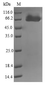 AmiB2 Protein - (Tris-Glycine gel) Discontinuous SDS-PAGE (reduced) with 5% enrichment gel and 15% separation gel.