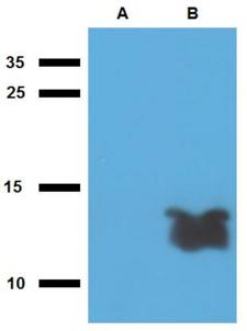 Mycobacterium tuberculosis Tb7.7 Antibody - Western blotting analysis of polyclonal anti-Mycobacterium tuberculosis antigen Tb7.7.  A) cell lysate of non-transfected E. coli, B) cell lysate of Tb7.7-transfected E. coli