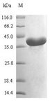 map/Methionine Aminopeptidase Protein - (Tris-Glycine gel) Discontinuous SDS-PAGE (reduced) with 5% enrichment gel and 15% separation gel.