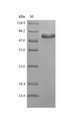 PIP / GCDFP-15 Protein - (Tris-Glycine gel) Discontinuous SDS-PAGE (reduced) with 5% enrichment gel and 15% separation gel.