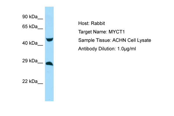 MYCT1 Antibody -  This image was taken for the unconjugated form of this product. Other forms have not been tested.