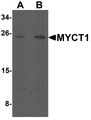 MYCT1 Antibody - Western blot analysis of MYCT1 in rat lung tissue lysate with MYCT1 antibody at (A) 1 and (B) 2 ug/ml.