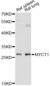 MYCT1 Antibody - Western blot analysis of extracts of various cell lines, using MYCT1 antibody at 1:3000 dilution. The secondary antibody used was an HRP Goat Anti-Rabbit IgG (H+L) at 1:10000 dilution. Lysates were loaded 25ug per lane and 3% nonfat dry milk in TBST was used for blocking. An ECL Kit was used for detection and the exposure time was 90s.
