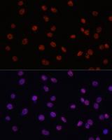 MYCT1 Antibody - Immunofluorescence analysis of C6 cells using MYCT1 Polyclonal Antibody at dilution of 1:100.Blue: DAPI for nuclear staining.