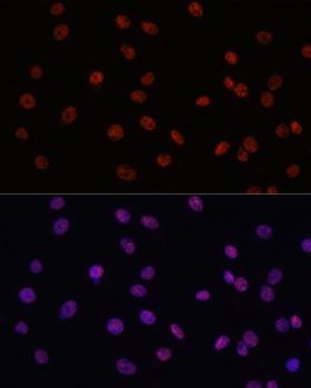 MYCT1 Antibody - Immunofluorescence analysis of C6 cells using MYCT1 Polyclonal Antibody at dilution of 1:100.Blue: DAPI for nuclear staining.