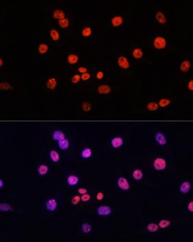 MYCT1 Antibody - Immunofluorescence analysis of HeLa cells using MYCT1 Polyclonal Antibody at dilution of 1:100.Blue: DAPI for nuclear staining.