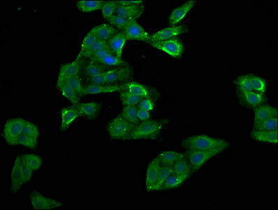 MYD118 / GADD45B Antibody - Immunofluorescence staining of HepG2 cells with GADD45B Antibody at 1:100, counter-stained with DAPI. The cells were fixed in 4% formaldehyde, permeabilized using 0.2% Triton X-100 and blocked in 10% normal Goat Serum. The cells were then incubated with the antibody overnight at 4°C. The secondary antibody was Alexa Fluor 488-congugated AffiniPure Goat Anti-Rabbit IgG(H+L).