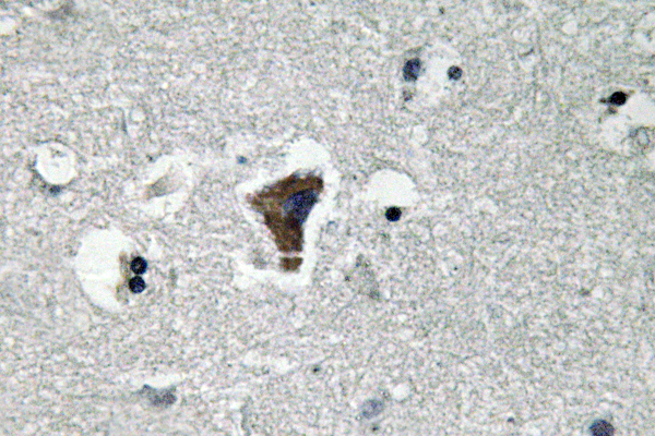 MYD88 Antibody - Immunohistochemistry analysis of MyD88 antibody in paraffin-embedded human brain tissue.