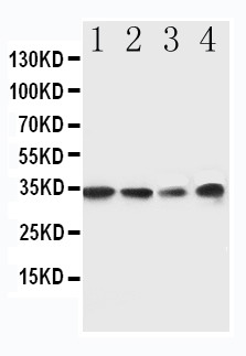 MYD88 Antibody - WB of MYD88 antibody. All lanes: Anti-MYD88 at 0.5ug/ml. Lane 1: Rat Spleen Tissue Lysate at 40ug. Lane 2: Rat Thymus Tissue Lysate at 40ug. Lane 3: JURKAT Whole Cell Lysate at 40ug. Lane 4: RAJI Whole Cell Lysate at 40ug. Predicted bind size: 33KD. Observed bind size: 35KD.